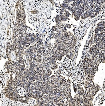 TAF4 Rabbit Polyclonal Antibody