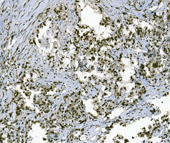 TAF4 Rabbit Polyclonal Antibody