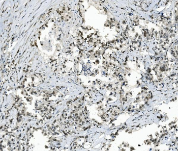 TAF4 Rabbit Polyclonal Antibody