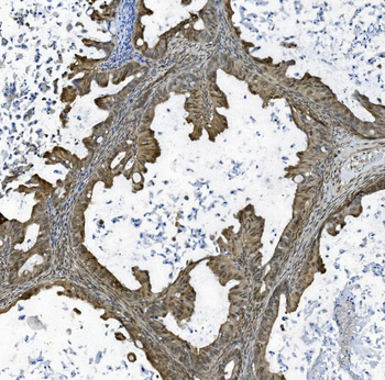 TAF4 Rabbit Polyclonal Antibody