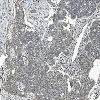 TAF4 Rabbit Polyclonal Antibody