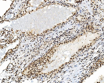 TAF4 Rabbit Polyclonal Antibody