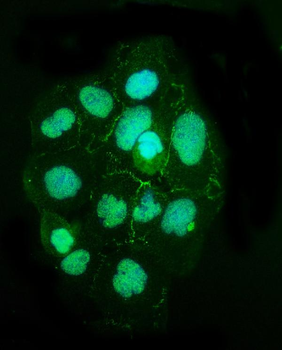 TJP2/ZO2 Rabbit Polyclonal Antibody