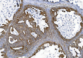TJP2/ZO2 Rabbit Polyclonal Antibody
