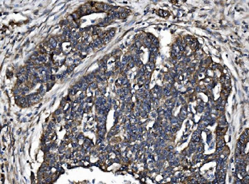 TJP2/ZO2 Rabbit Polyclonal Antibody