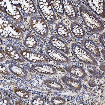 TJP2/ZO2 Rabbit Polyclonal Antibody