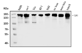 TJP2/ZO2 Rabbit Polyclonal Antibody
