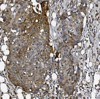 ALK-1/ACVRL1/ALK Rabbit Polyclonal Antibody