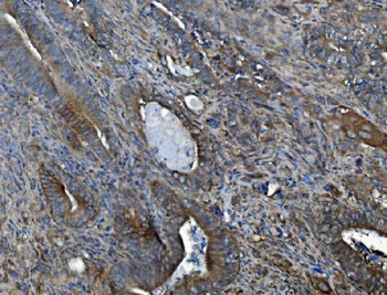 ALK-1/ACVRL1/ALK Rabbit Polyclonal Antibody