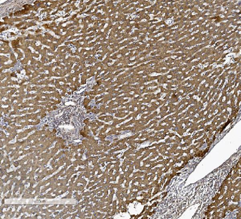 ALK-1/ACVRL1/ALK Rabbit Polyclonal Antibody