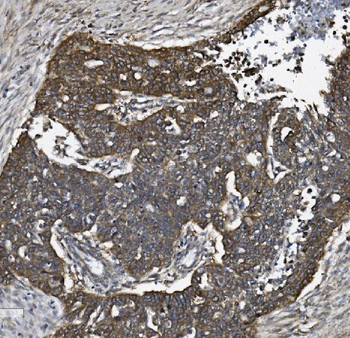 ALK-1/ACVRL1/ALK Rabbit Polyclonal Antibody