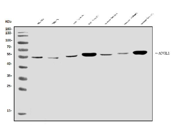 ALK-1/ACVRL1/ALK Rabbit Polyclonal Antibody