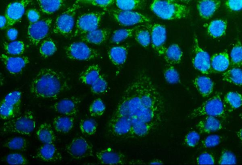CHCHD10 Rabbit Polyclonal Antibody