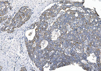 CHCHD10 Rabbit Polyclonal Antibody