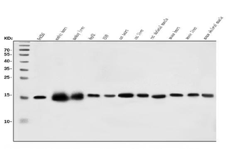 CHCHD10 Rabbit Polyclonal Antibody