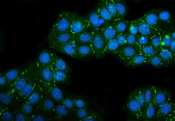 Claudin 3/CLDN3 Rabbit Polyclonal Antibody