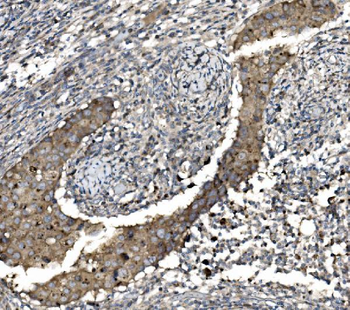 Claudin 3/CLDN3 Rabbit Polyclonal Antibody