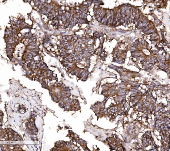 Claudin 3/CLDN3 Rabbit Polyclonal Antibody