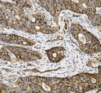 Claudin 3/CLDN3 Rabbit Polyclonal Antibody