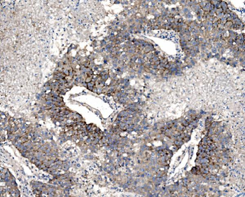 Claudin 3/CLDN3 Rabbit Polyclonal Antibody