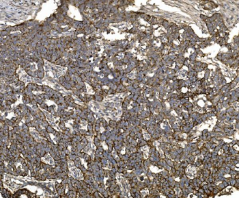Claudin 3/CLDN3 Rabbit Polyclonal Antibody