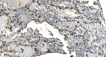 Coronin 1a/TACO/CORO1A Rabbit Polyclonal Antibody