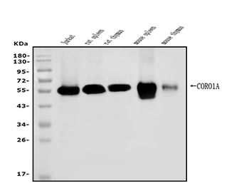 Coronin 1a/TACO/CORO1A Rabbit Polyclonal Antibody