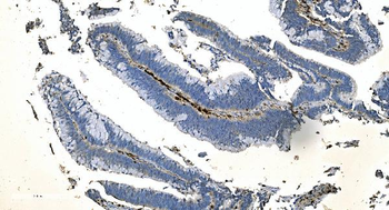 Coronin 1a/TACO/CORO1A Rabbit Polyclonal Antibody