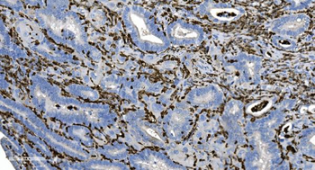 Coronin 1a/TACO/CORO1A Rabbit Polyclonal Antibody