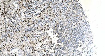 Coronin 1a/TACO/CORO1A Rabbit Polyclonal Antibody