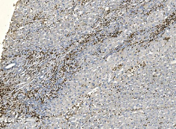 Coronin 1a/TACO/CORO1A Rabbit Polyclonal Antibody
