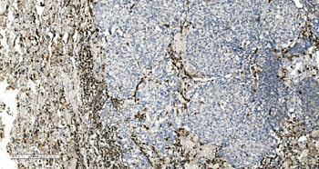 Coronin 1a/TACO/CORO1A Rabbit Polyclonal Antibody