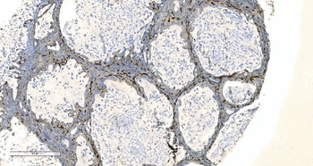 Coronin 1a/TACO/CORO1A Rabbit Polyclonal Antibody