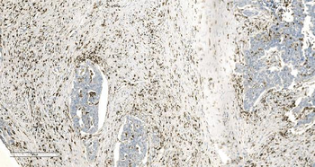 Coronin 1a/TACO/CORO1A Rabbit Polyclonal Antibody