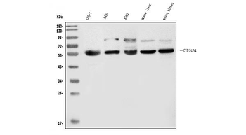 CYP51A1/CYP51 Rabbit Polyclonal Antibody