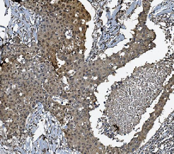 DCTN1/p150-glued Rabbit Polyclonal Antibody