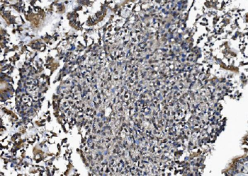 DCTN1/p150-glued Rabbit Polyclonal Antibody
