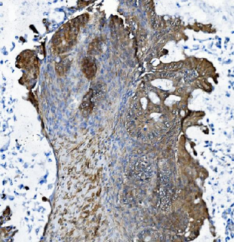 DCTN1/p150-glued Rabbit Polyclonal Antibody