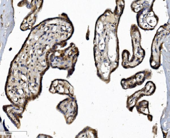 DCTN1/p150-glued Rabbit Polyclonal Antibody