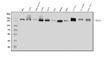 DCTN1/p150-glued Rabbit Polyclonal Antibody