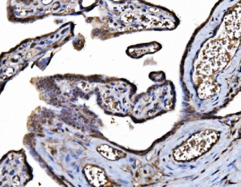DYNLL1/PIN Rabbit Polyclonal Antibody