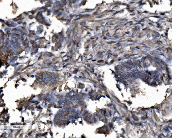DYNLL1/PIN Rabbit Polyclonal Antibody