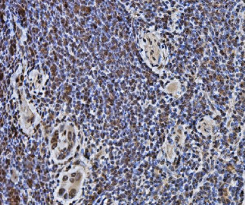 DYNLL1/PIN Rabbit Polyclonal Antibody