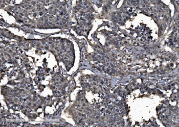 DYNLL1/PIN Rabbit Polyclonal Antibody