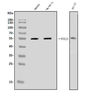 FOXJ1 Rabbit Polyclonal Antibody