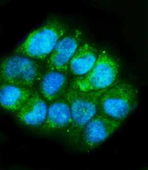 Aspartate Aminotransferase/GOT1 Rabbit Polyclonal Antibody