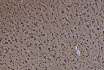 FABP-1/GOT2/FABP Rabbit Polyclonal Antibody