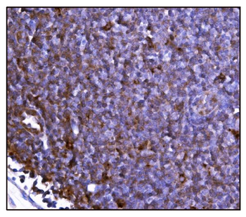 FABP-1/GOT2/FABP Rabbit Polyclonal Antibody