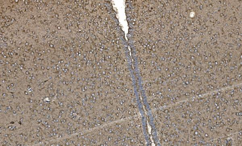 FABP-1/GOT2/FABP Rabbit Polyclonal Antibody