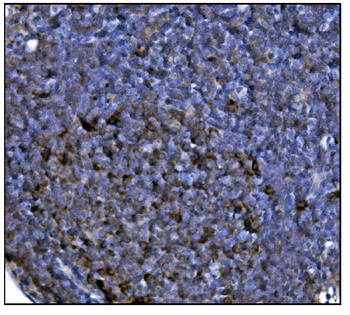 FABP-1/GOT2/FABP Rabbit Polyclonal Antibody